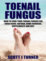 Toenail Fungus: How to Cure Your Toenail Fungus for Good using Natural Home Remedies, Supplements and Diet