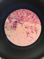 Cisitcercosis: enfermedad parasitaria