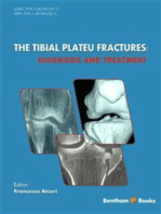 The Tibial Plateau Fractures