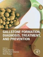 Gallstone Formation, Diagnosis, Treatment and Prevention