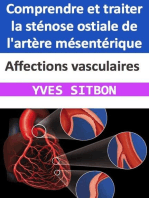Affections vasculaires : Comprendre et traiter la sténose ostiale de l'artère mésentérique