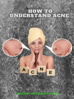 Understanding acne